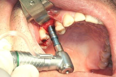 Img 2803 sx1dst - Eugenol