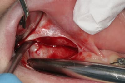 Img 2925 jrpiyr - Eugenol