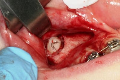 Img 2930 amfavh - Eugenol