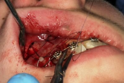 Img 2932 a0sjs3 - Eugenol