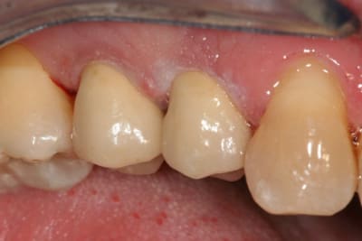 Img 2975 eyvzsm - Eugenol