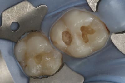 Img 2983 r1hemb - Eugenol