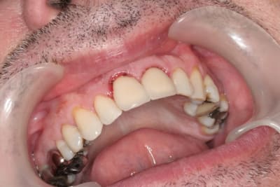 Img 3019 opg6a4 - Eugenol