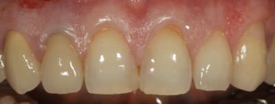 Img 3201 gi3vew - Eugenol