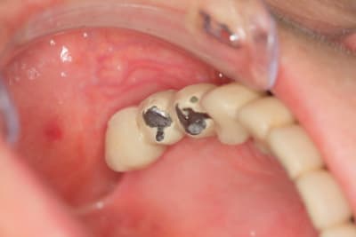 Img 3203 lsmsen - Eugenol