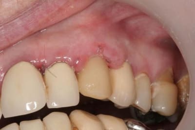 Img 3211 uvma8d - Eugenol