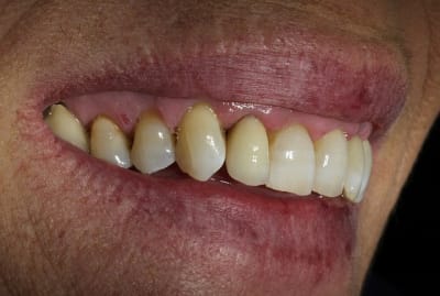 Img 3296 ylh9sm - Eugenol