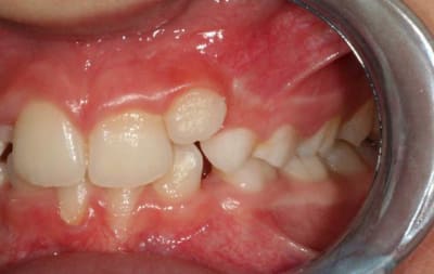 Img 3362 yvamxd - Eugenol