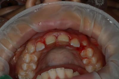 Img 3379 z2xfxt - Eugenol