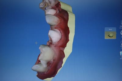 Img 3524 ph3h89 - Eugenol