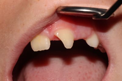 Img 3525 erhby4 - Eugenol