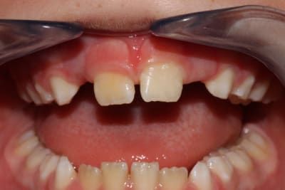 Img 3526 xozegg - Eugenol