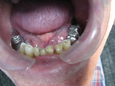 Img 3612 guo6fz - Eugenol