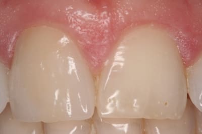 Img 3711 tmlosb - Eugenol