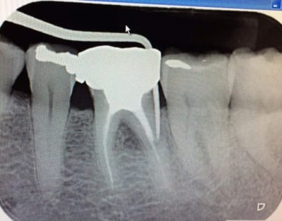 Img 3725 gftiqv - Eugenol