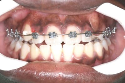 Img 3 knc5fx - Eugenol