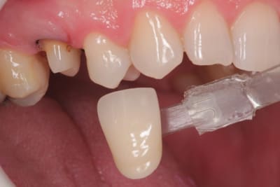 Img 4025 ceneom - Eugenol