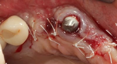 Img 4245 fymfjh - Eugenol