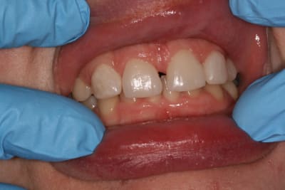 Img 4295 kgttti - Eugenol