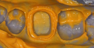 Img 4312 ysce15 - Eugenol