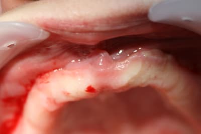 Img 4545 zfdsy1 - Eugenol