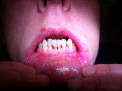 Img 4615 d7jke7 - Eugenol