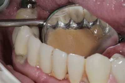 Img 4623 xwif4t - Eugenol