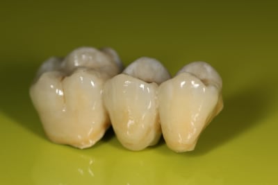 Img 4699 1 bolwft - Eugenol