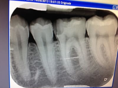 Img 4752 emfwu0 - Eugenol