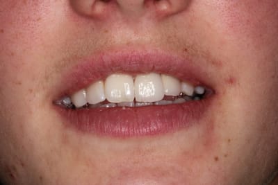 Img 4757 b7se3m - Eugenol