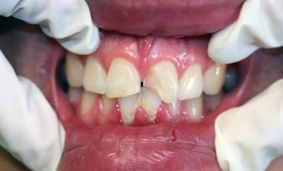 Img 4795 uudhln - Eugenol