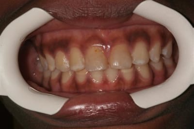 Img 4832  small  rcfrsz - Eugenol