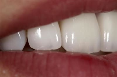 Img 4872  large  irchhu - Eugenol