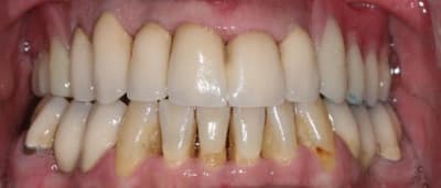 Img 4917 w8nelo - Eugenol