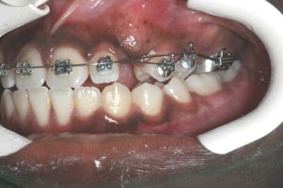 Img 4 rlq8zd - Eugenol