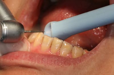 Img 5146 q3cucq - Eugenol