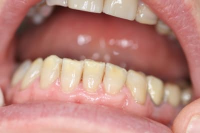 Img 5154 aj0ps2 - Eugenol