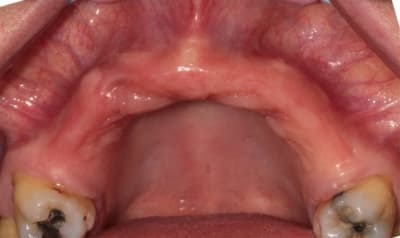 Img 5347 jrlxtp - Eugenol