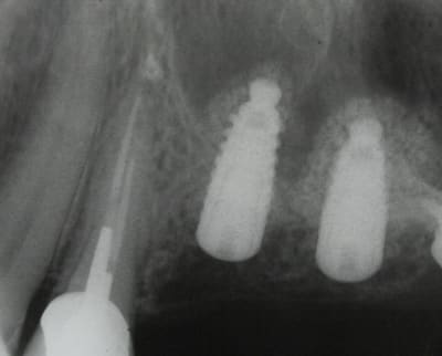 Img 5494 vw7kg2 - Eugenol