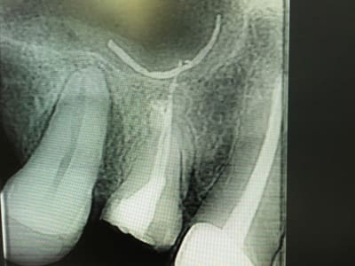 Img 5575 vga8kv - Eugenol