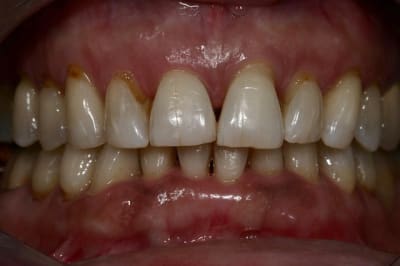 Img 5721  custom  w8zujv - Eugenol