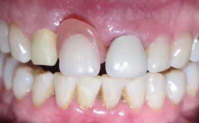 Img 5804 rvn38o - Eugenol