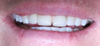 Img 5816 okgijh - Eugenol