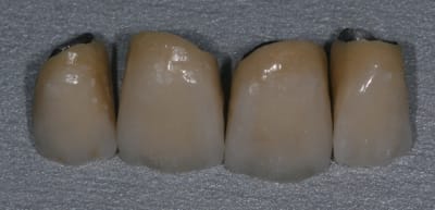 Img 5983 rduyfh - Eugenol