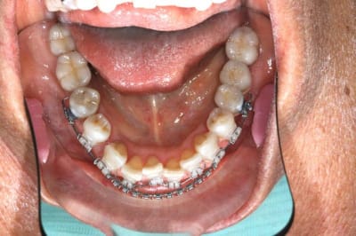 Img 5 wstuvp - Eugenol