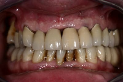 Img 6290 llkwh2 - Eugenol