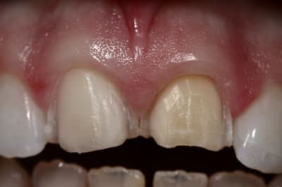 Img 6415  1024x768  bt5eja - Eugenol