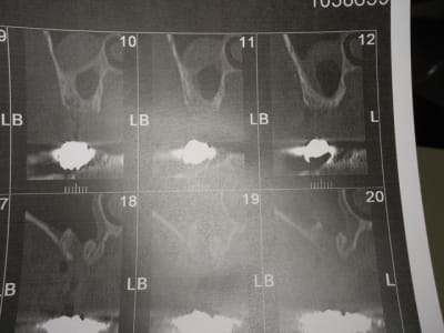 Img 6814 yn5mh9 - Eugenol