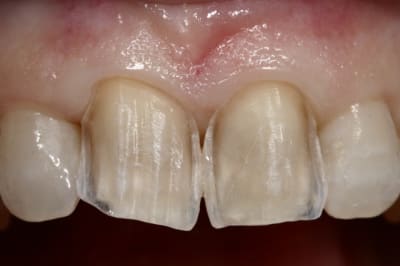 Img 6981 udgchp - Eugenol