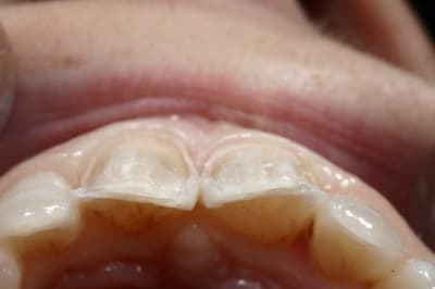 Img 6985 phppbt - Eugenol